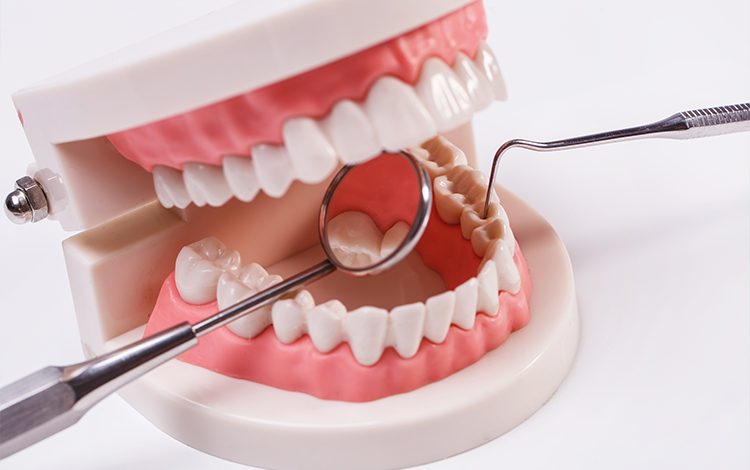 gevoelige tanden symptomen