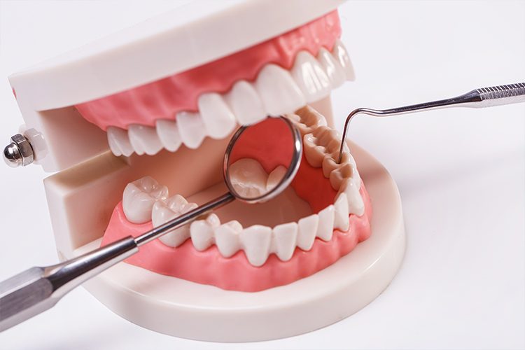gevoelige tanden symptomen